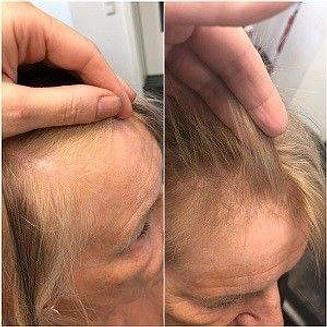№5 Кислородная эмульсия против выпадения и для роста волос Inclip, 50 мл INCLIP