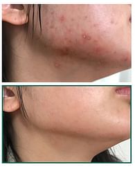 Сыворотка для проблемной кожи SOME BY MI AHA BHA PHA 30 Days Miracle Serum, 50 мл.