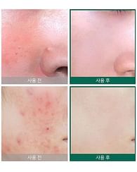 Кислотная сыворотка для проблемной кожи SOME BY MI AHA BHA PHA 30 Days Miracle Serum, 50мл. Кислотная сыворотка для проблемной кожи SOME BY MI AHA BHA PHA 30 Days Miracle Serum, 50мл.