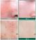 Восстанавливающий крем для проблемной кожи SOME BY MI AHA-BHA-PHA 30 Days Miracle Cream, 60гр.