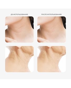 Регенерирующий антивозрастной крем для шеи и декольте с PDRN лосося Arocell Super Neck Cream 80мл Регенерирующий антивозрастной крем для шеи и декольте с PDRN лосося Arocell Super Neck Cream 80мл