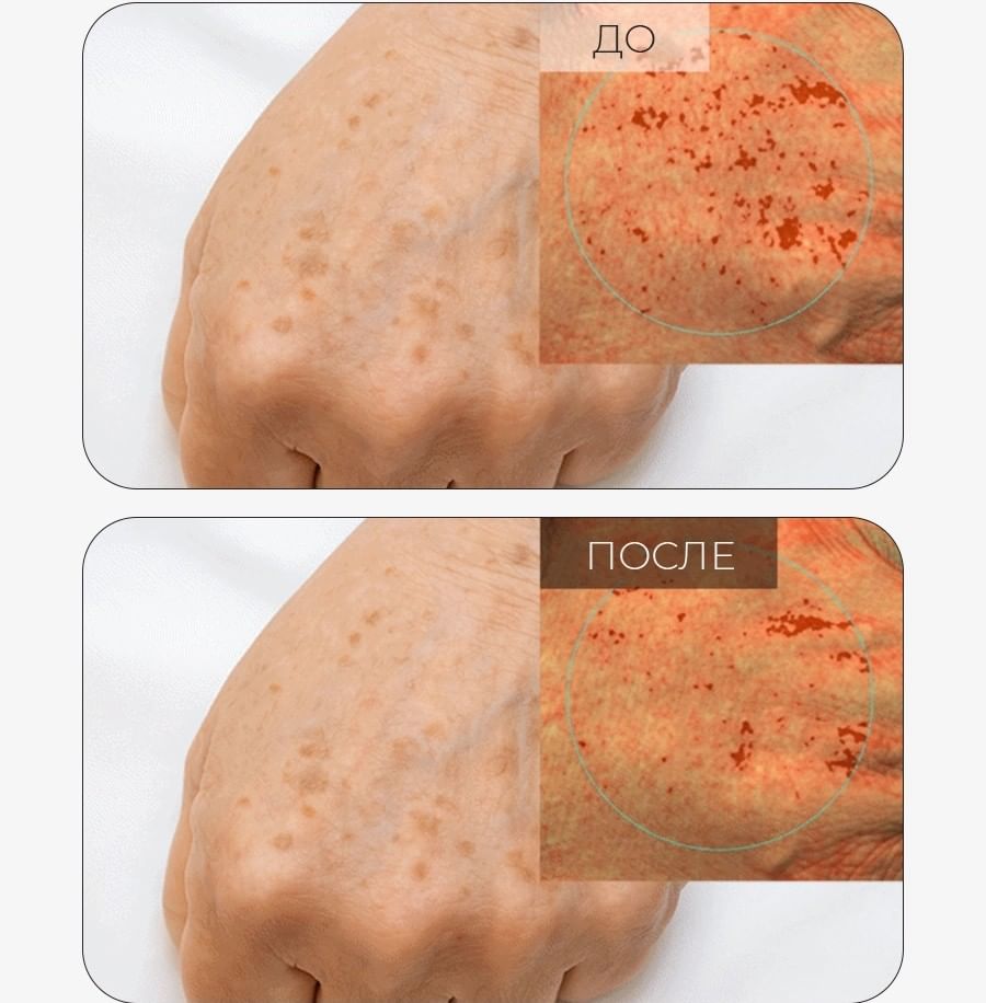 Солнцезащитная сыворотка с транексамовой кислотой, мелатонином и глутатионом Arocell Mela TXA Sun Serum SPF50 40 мл